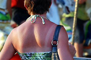 熱啊!  3招防暑熱傷害