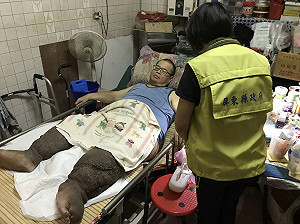 各界愛心湧入  象腿林先生將北上就醫