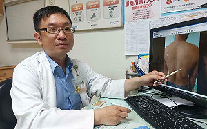 水痘案例狂增亦需隔離 光田醫籲未感染者盡速接種疫苗