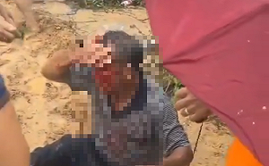 (影) 中共暴力鎮壓! 廣東百姓被打頭破血流 濟南民眾抵制垃圾填湖被噴辣椒水