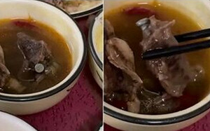 (影) 理論上 中國已嚐過人肉的滋味了！ 用遺體作骨骼移植材料 民眾吃肉驚見鋼釘