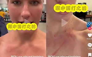 打法太過凶殘？澳洲、中國水球隊 網上互秀身上抓痕 