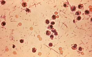 日本東京發生志賀氏桿菌食物中毒 24年來首見