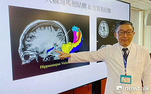 台中榮總創新研究 思覺失調症有望科學化診療