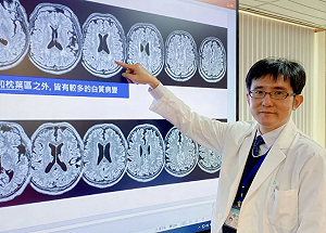 台灣特有基因變異恐致中風失智!研究:48歲後腦部病變風險驟增