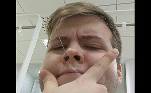 《鬥陣特攻》美攻擊手Taimou長腫瘤：就叫它慈悲囉！