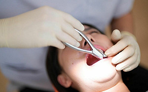 正妹遭拔錯牙！醫院沒打麻醉用鐵絲硬綁回不認錯　她難忍劇痛墜樓亡