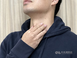 男星方基墨生前罹喉癌 醫:注意聲音改變等警訊