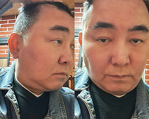 徐亨自揭腦瘤水腦症 離婚淨身出戶