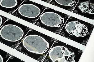 比米粒還小的鼠腦! 繪出史上最精細3D腦圖 科學家打造神經連結「宇宙地圖」