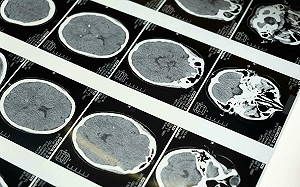 比米粒還小的鼠腦! 繪出史上最精細3D腦圖 科學家打造神經連結「宇宙地圖」