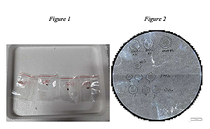 真菌武器植入美國？ 2中國人被控「預謀走私有害真菌」 恐重創美農業