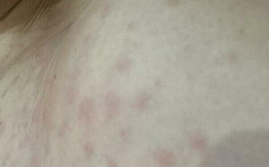 癢到懷疑人生？醫點名4種家中難發現的蟲　防治攻略一次看