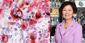 中研院士陳景虹 抗癌新發現抑制淋巴瘤