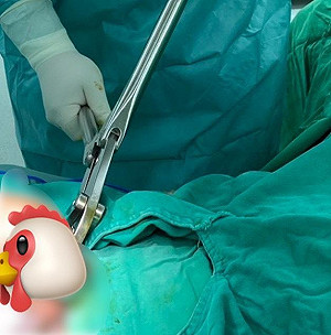 差點成公公！男用「情趣環」竟卡住  醫動鋼針剪搶救「象拔蚌」