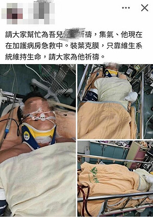 台電員工搶修遭電擊命危!最新情況:已恢復「微弱心跳」