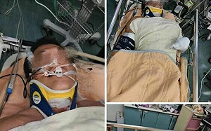 台電員工搶修遭電擊命危！最新情況：已恢復「微弱心跳」