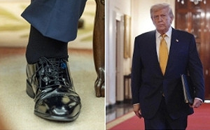 腿腫、手瘀照瘋傳！白宮：川普「慢性靜脈功能不全」 腿部腫脹、手部瘀青