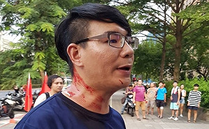 陳重生觀點》虎父無犬子？