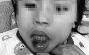 台東特幼班教師狠虐6幼童!東檢起訴4教保人員求處重刑