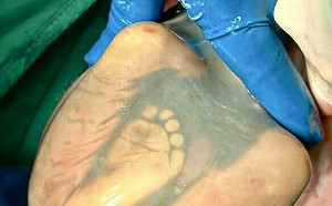 婦產名醫門診察覺異狀 急剖腹救雙胞胎脫險！陳志金感動轉發過程全曝光