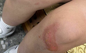 台中2少女看電影遭毆打！父怒批影城應變消極 將提告施暴男