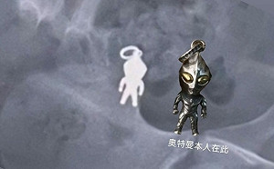 7歲男童誤吞「奧特曼吊飾」 X光照曝光網笑翻