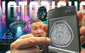 館長自曝「腦血管萎縮」! 健檢驚見X光片現白色陰影 將做MRI檢查