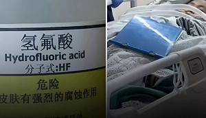 真有韋小寶「化骨水」!  杭州婦女踩到送醫不治 網 : 只要沾血就「無盡殺戮」