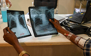 印度結核病危機續惡化 專家憂莫迪「2025根除目標」恐淪空談