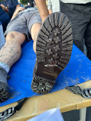 厚底防滑鞋仍遭玻璃刺穿！花蓮慈院示警外科傷患暴增 縫合手術破500例