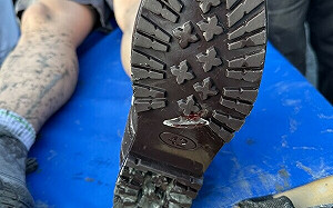 厚底防滑鞋仍遭玻璃刺穿！花蓮慈院示警外科傷患暴增 縫合手術破500例