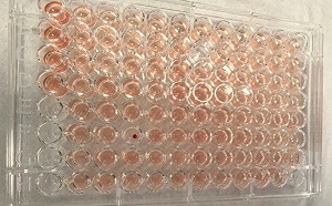 比「熊貓血」還稀奇百倍! 佛山發現超罕見「鑽石血」 提供「關鍵儲備」