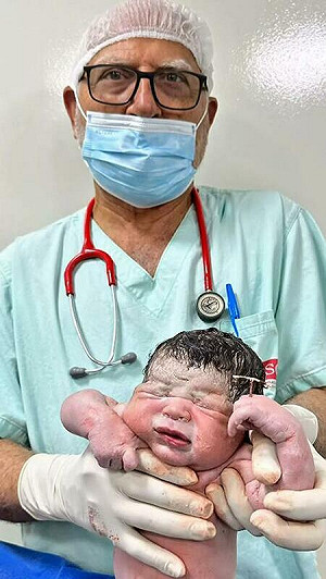 1%天選之人！巴西寶寶出生竟「手握T字避孕器」 網友：這局算你贏......