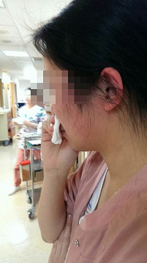 鄉代摑護理師巴掌  衛福部：盼修法加重刑責