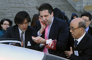 美國駐韓大使遇襲  血流滿面