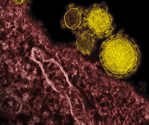 德國MERS死亡首例  男子遊中東後發病