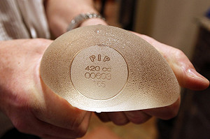 PIP假乳  法國出現20個罹癌病例