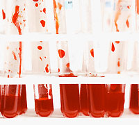 中國成都驚爆「血漿種花」事件