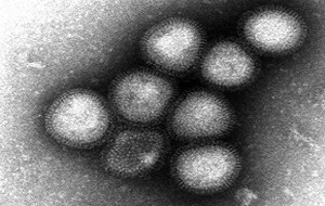 禽流感統計分析  H7N9大流行可能性低