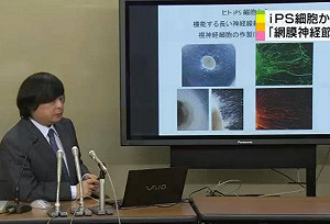 世界第1！iPS細胞發展成視網膜神經節細胞