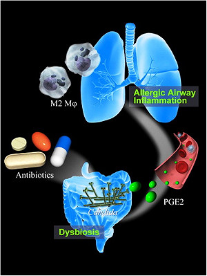 腸道壞菌引發氣喘  抗生素讓過敏更惡化