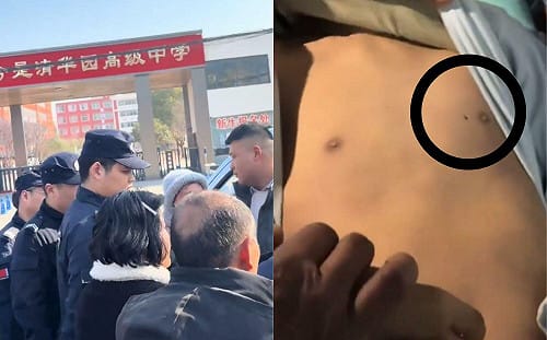 河南少年死狀太驚悚！家屬崩潰曝遺照求真相  專業人士剖析：胸口釘子洞疑遭穿刺