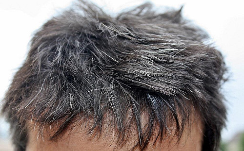 吃黑補黑髮有影嘸？醫師：假的！沒有直接關係