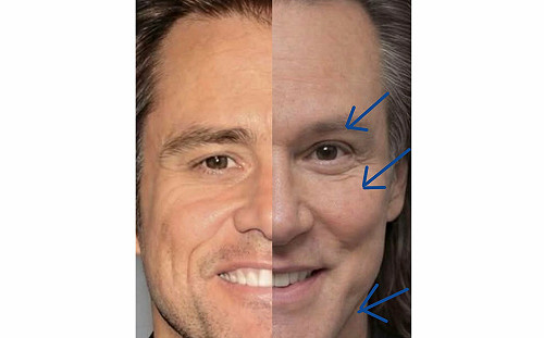 20年對比照瘋傳！金凱瑞被疑「換人」 醫曝真相：可能做過「這幾項」醫美