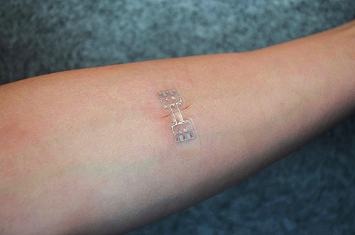 擺脫傳統縫合醫療  美推類OK蹦癒合裝置