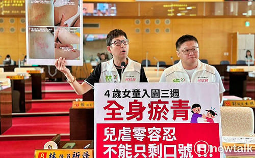 （影）4歲女童幼兒園遭虐全身傷   林祈烽痛批中市府通報牛步