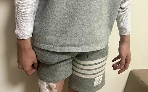 苗栗護理師遭隨機砍傷是假的！警方調查大逆轉 自導自演想「討拍」