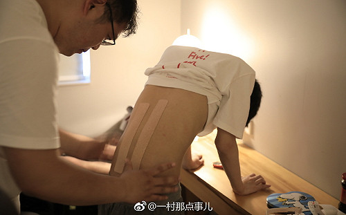 英雄聯盟季中賽》備戰四強賽！RNG輔助背上貼滿膏藥