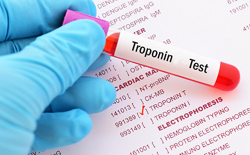 新型心肌梗塞診斷超快！1小時就有結果